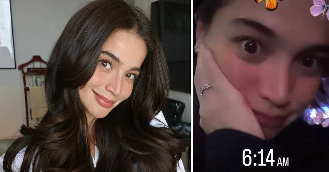 Anne Curtis, ibinahagi ang problemang pinagdaanan bago ang 'Magpasikat' performance Anne Curtis, ibinahagi ang problemang pinagdaanan bago ang 'Magpasikat' performance