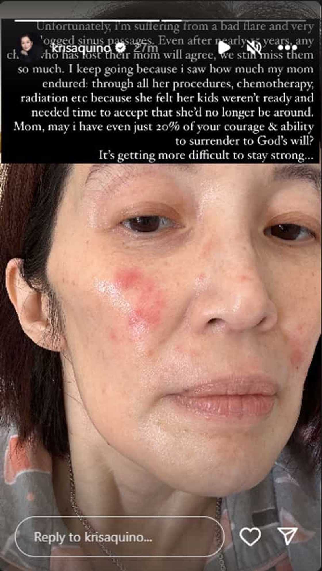 Kris Aquino Kris Aquino
