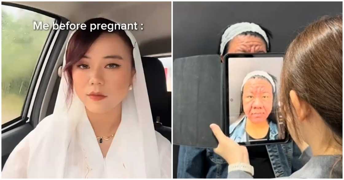 Woman, 28, experiences drastic facial changes during her pregnancy Woman, 28, experiences drastic facial changes during her pregnancy