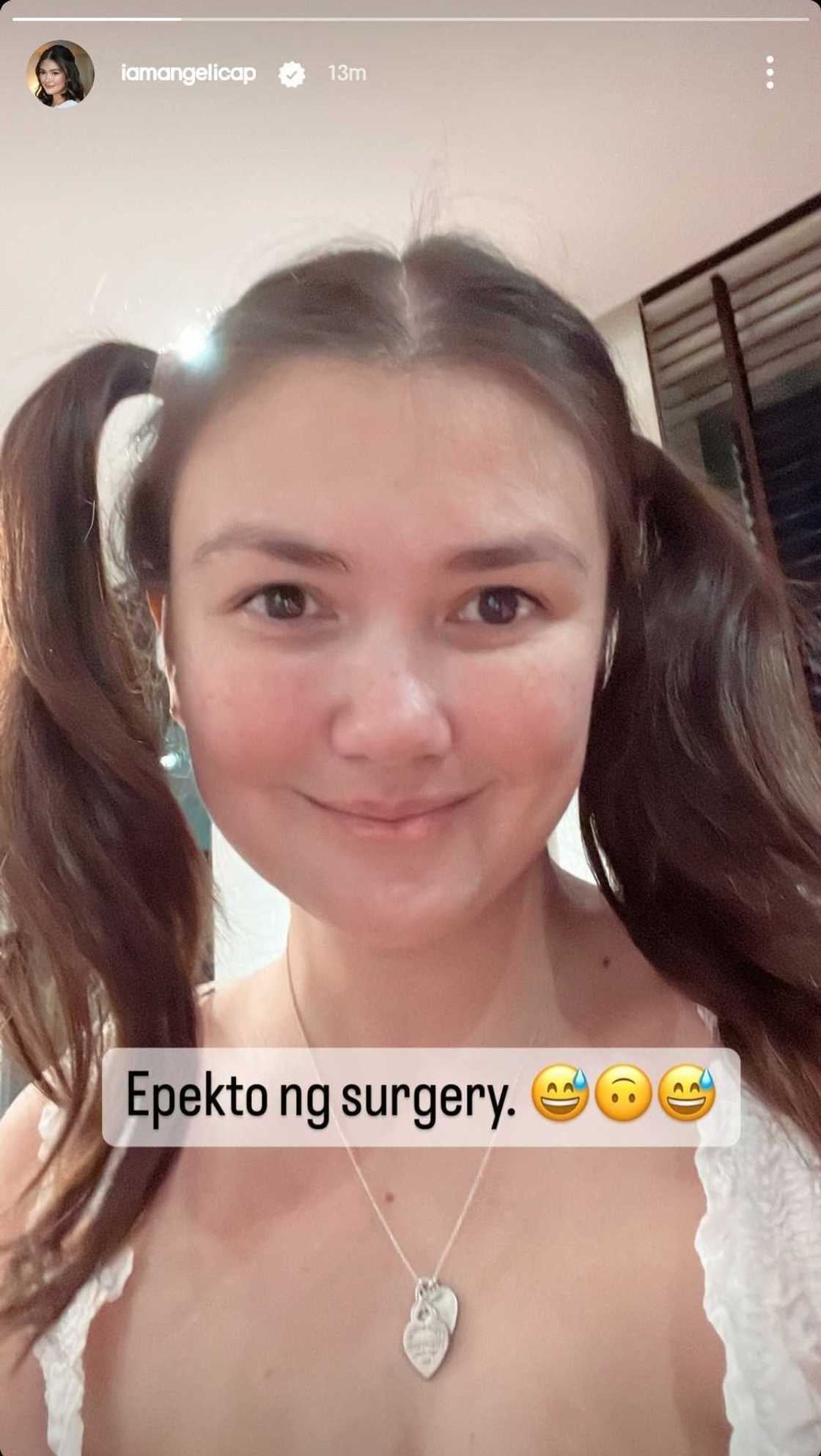 Angelica Panganiban, may makuwelang post patungkol sa "epekto ng surgery"