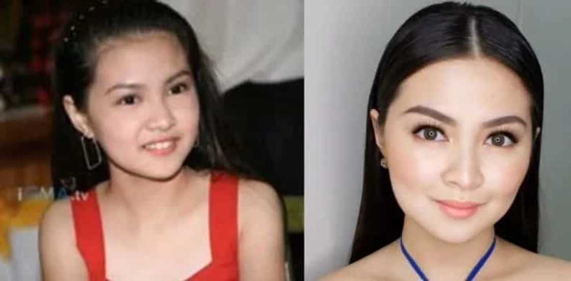 Noon at ngayon: These 16 Filipina celebrities experienced drastic transformation after hitting puberty Noon at ngayon: These 16 Filipina celebrities experienced drastic transformation after hitting puberty