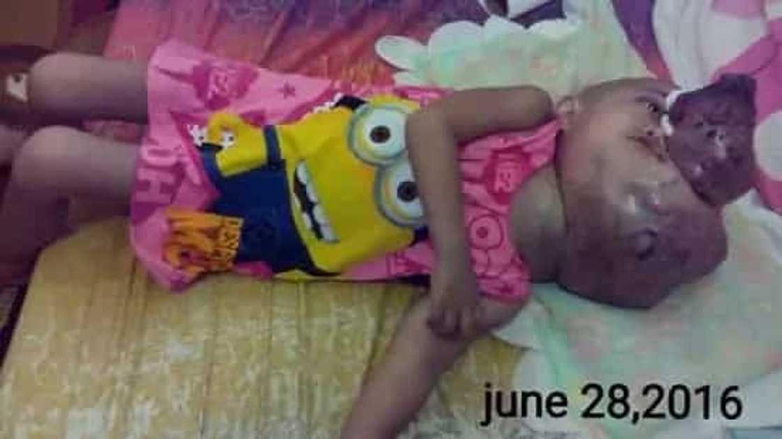 2-year old fights cancer bravely 2-year old fights cancer bravely