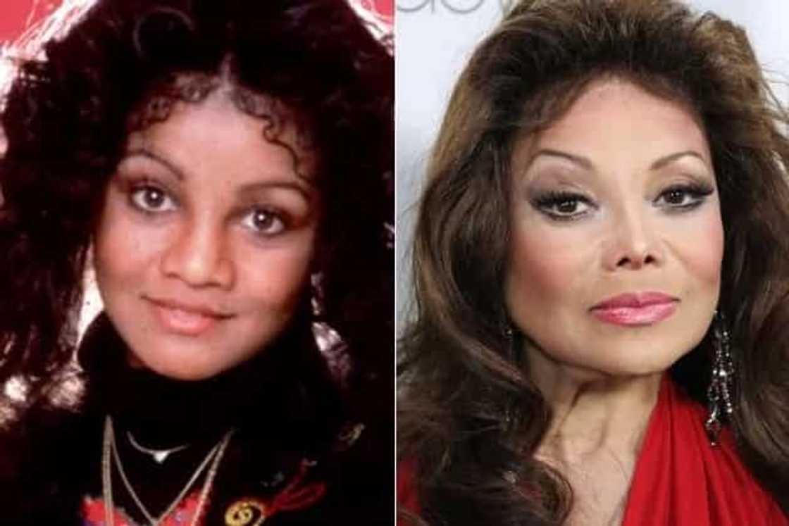 These 7 ladies turned out for the worse after failed surgeries