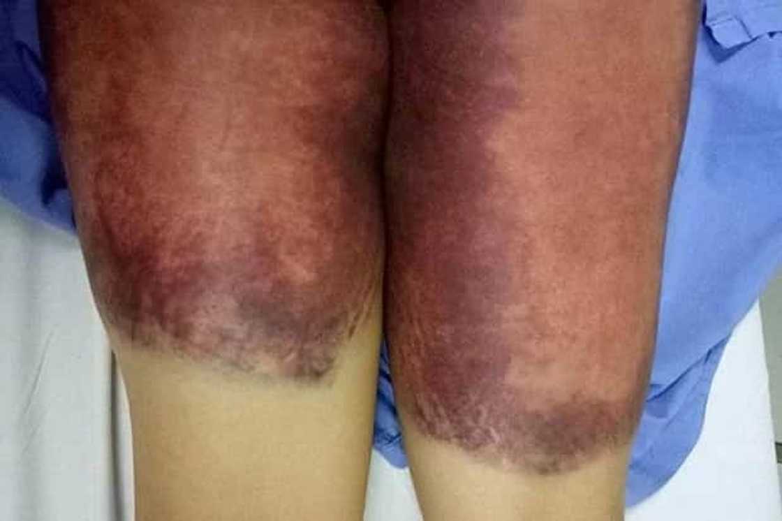 18-year-old girl ends up in hospital after brutal hazing 18-year-old girl ends up in hospital after brutal hazing