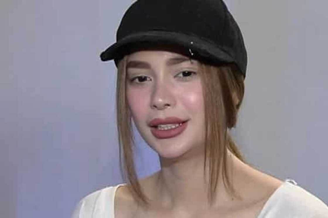 Arci Muñoz's nose gets much attention for being a 'new model' every year