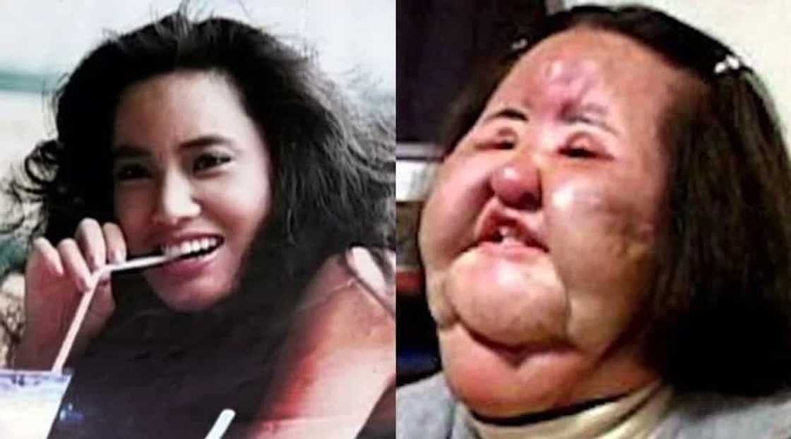 These 7 ladies turned out for the worse after failed surgeries These 7 ladies turned out for the worse after failed surgeries
