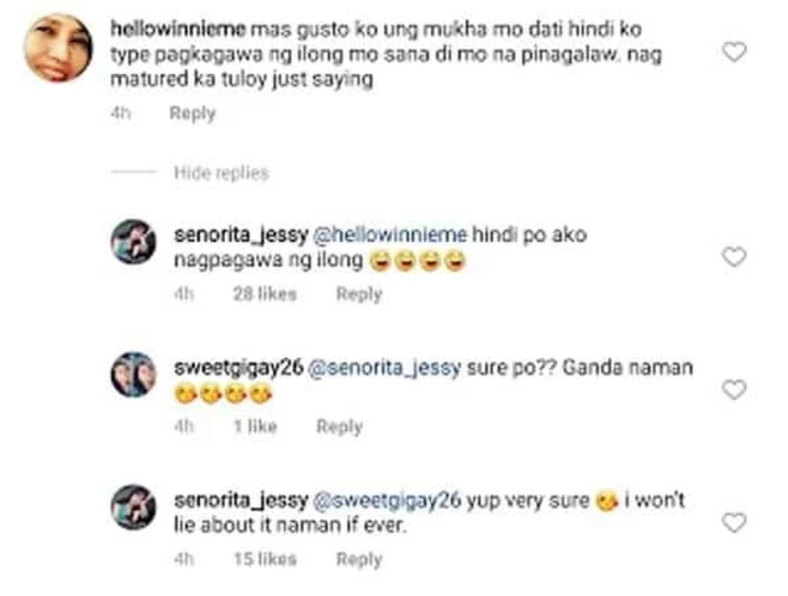 Jessy Mendiola vehemently denies that she had a nose job Jessy Mendiola vehemently denies that she had a nose job