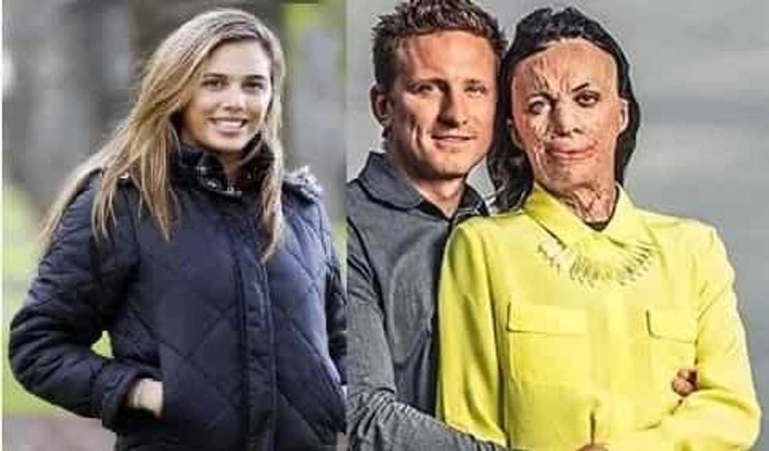 Man set to marry his model girlfriend who suffered severe burns Man set to marry his model girlfriend who suffered severe burns