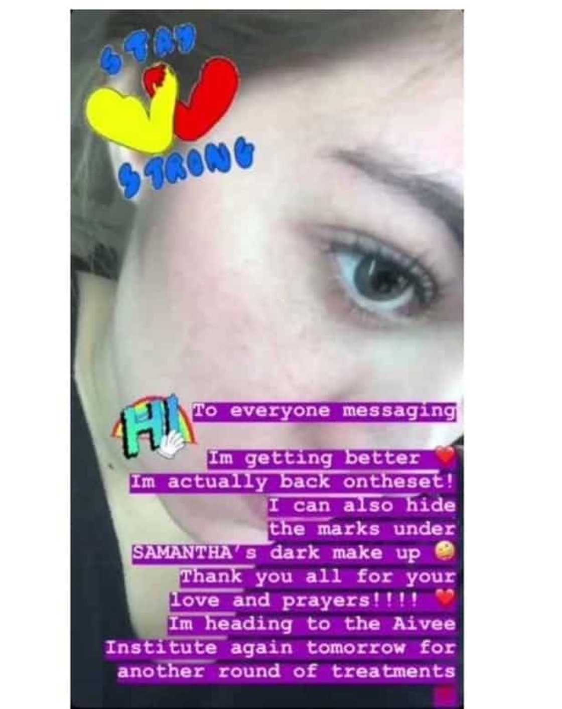 Pumutok ang mga ugat sa mukha! Shaina Magdayao, bumubuti na daw ang kalagayan Pumutok ang mga ugat sa mukha! Shaina Magdayao, bumubuti na daw ang kalagayan