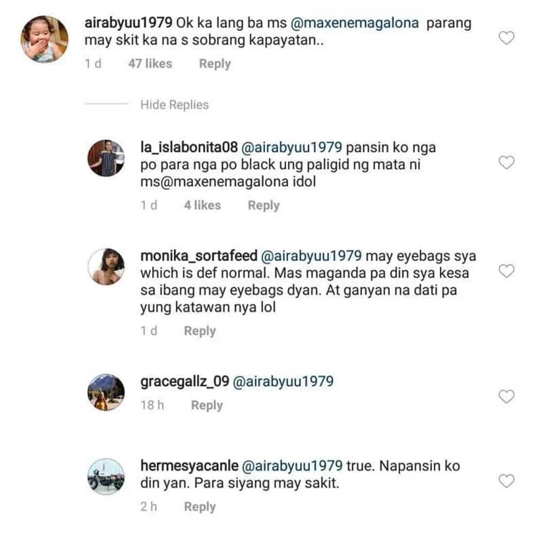 Ugly black marks around Maxene Magalona's eye leave netizens speculating on her situation Ugly black marks around Maxene Magalona's eye leave netizens speculating on her situation