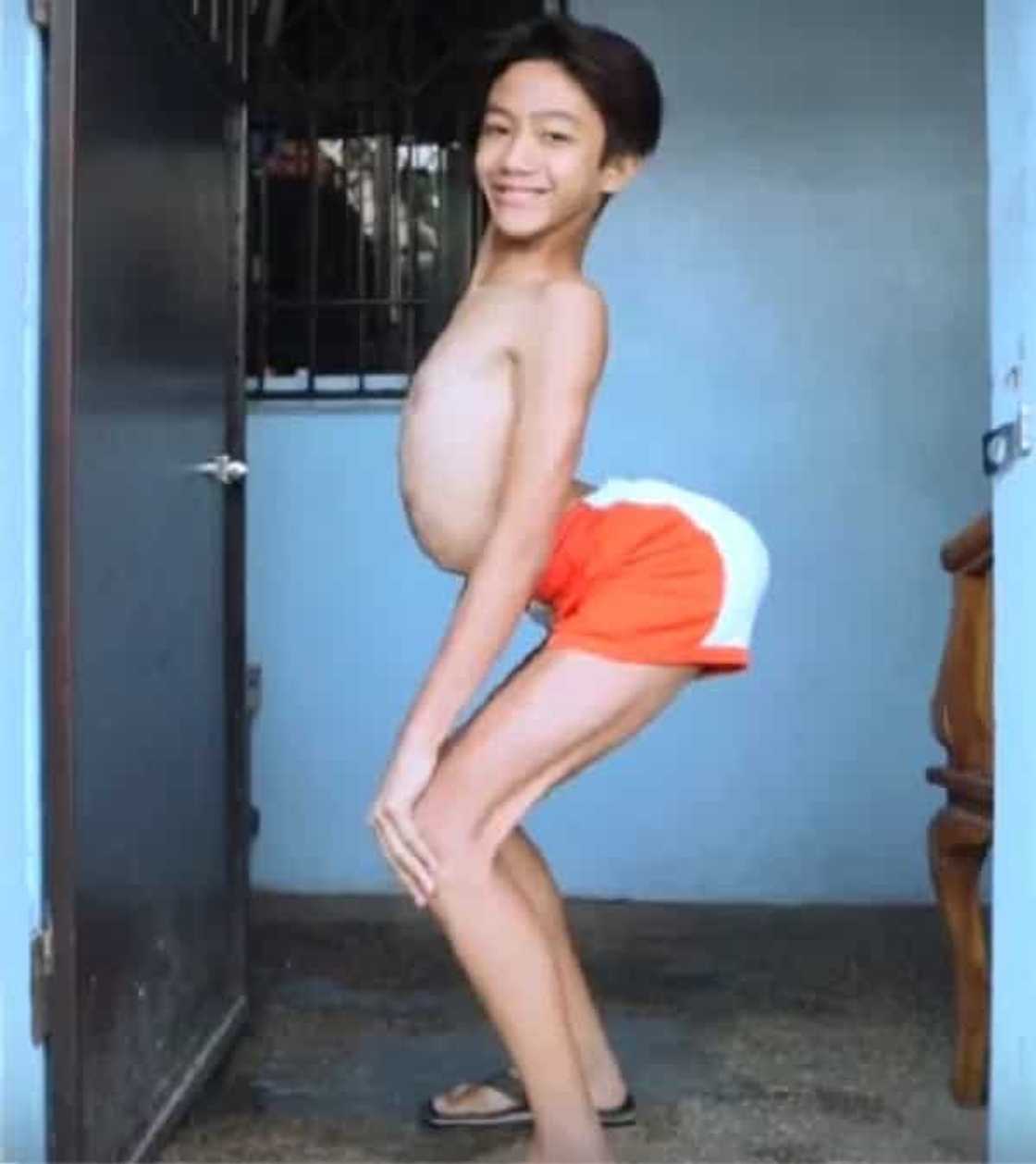 Netizen Dubbed as “Most Flexible Boy” in the Philippines Because of His Stunning Antics