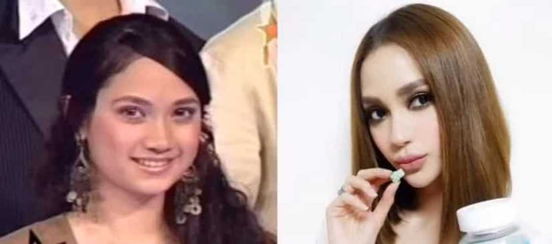 Noon at ngayon: These 16 Filipina celebrities experienced drastic transformation after hitting puberty Noon at ngayon: These 16 Filipina celebrities experienced drastic transformation after hitting puberty