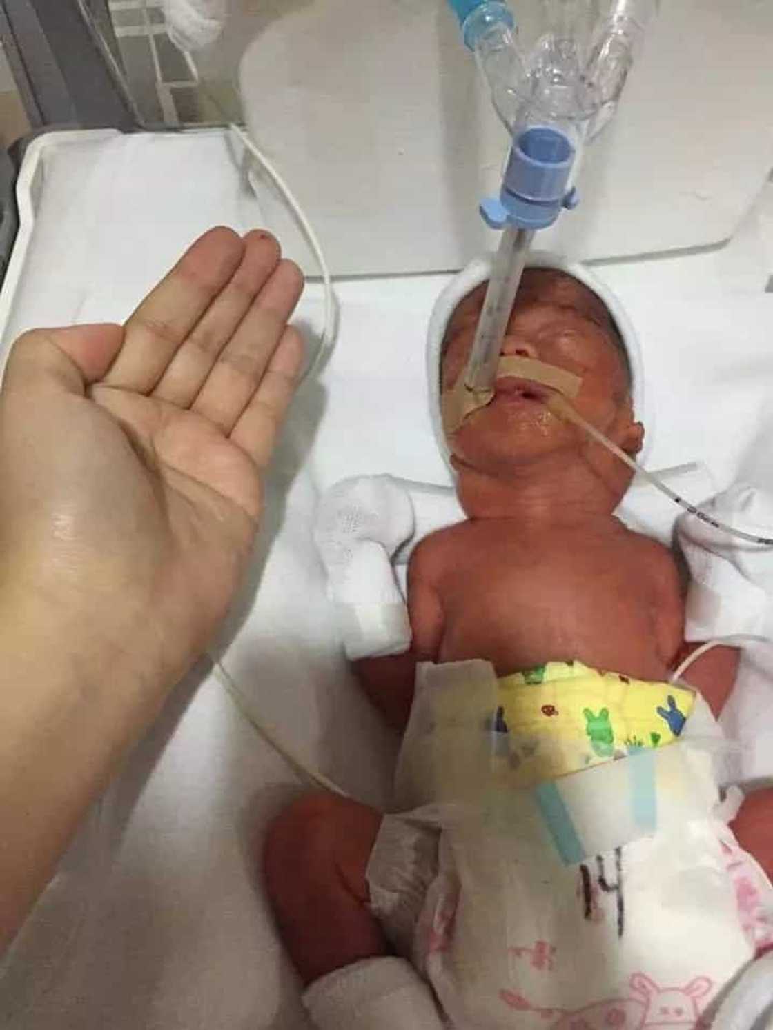 Pinay mother shares miraculous recovery of premature baby Pinay mother shares miraculous recovery of premature baby