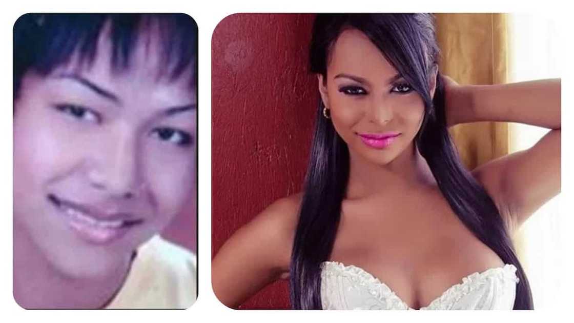 6 Remarkable Pinoy transgender before and after surgery 6 Remarkable Pinoy transgender before and after surgery