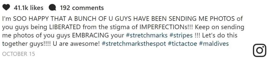 Denise Laurel proud of her stretch marks; encourages women to embrace their "stripes" Denise Laurel proud of her stretch marks; encourages women to embrace their "stripes"