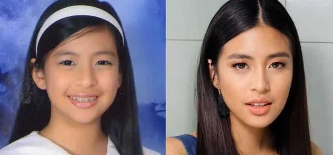 Noon at ngayon: These 16 Filipina celebrities experienced drastic transformation after hitting puberty Noon at ngayon: These 16 Filipina celebrities experienced drastic transformation after hitting puberty