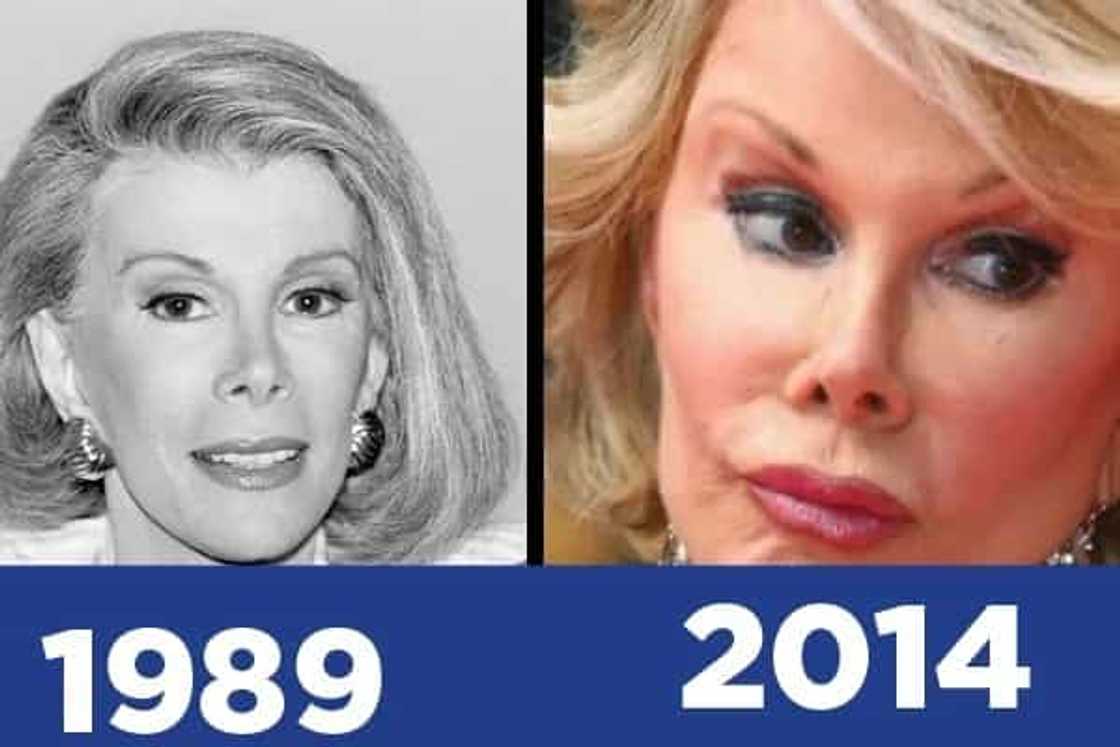 This is how the plastic surgery looks like This is how the plastic surgery looks like