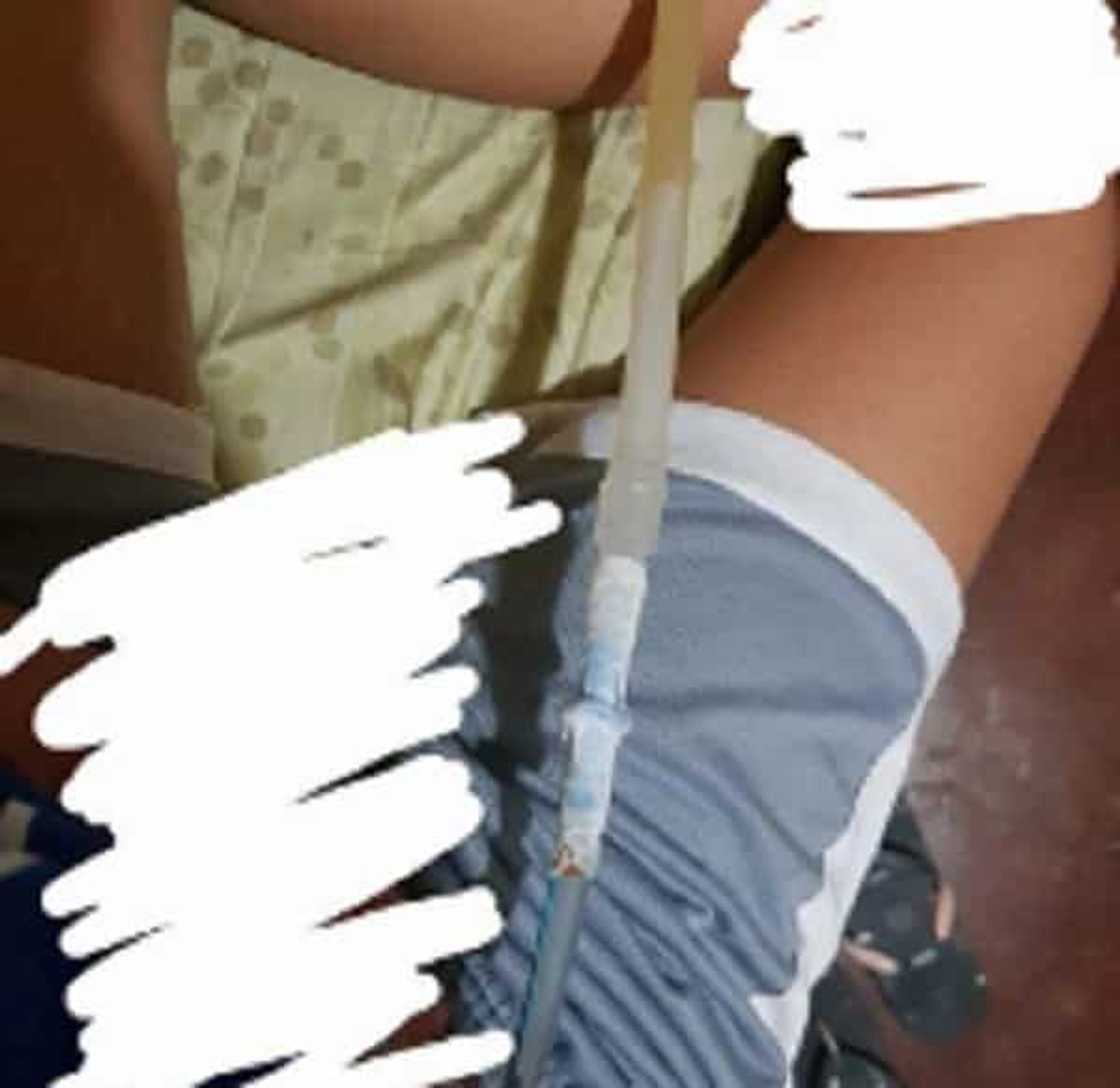 College Student na mahilig magpatuyo ng pawis, nauwi sa malubhang sakit College Student na mahilig magpatuyo ng pawis, nauwi sa malubhang sakit