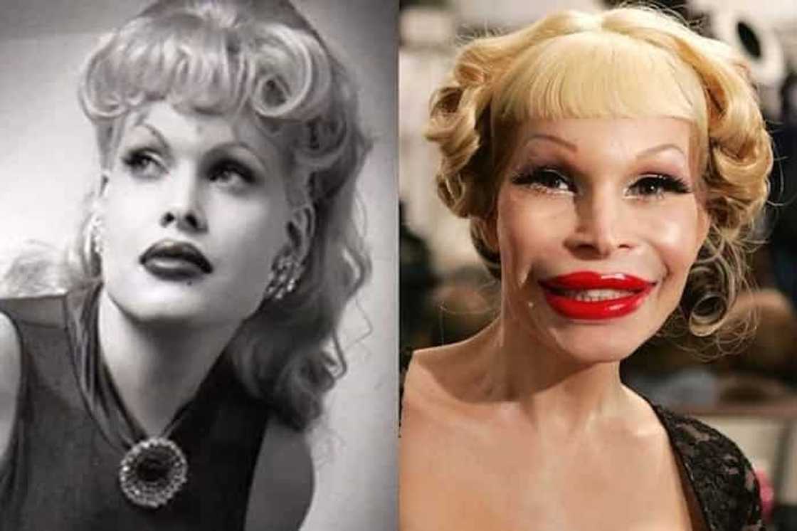 These 7 ladies turned out for the worse after failed surgeries These 7 ladies turned out for the worse after failed surgeries