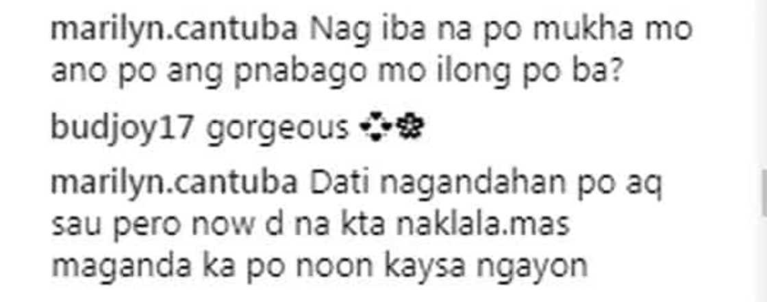 Jessy Mendiola vehemently denies that she had a nose job Jessy Mendiola vehemently denies that she had a nose job