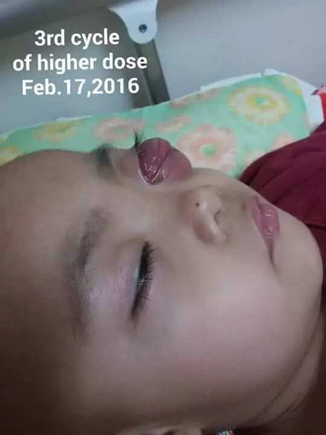 2-year old fights cancer bravely 2-year old fights cancer bravely