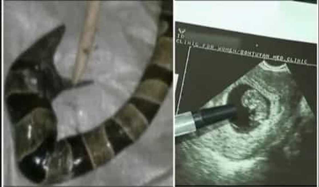 Woman gave birth to a snake in Cotabato Woman gave birth to a snake in Cotabato
