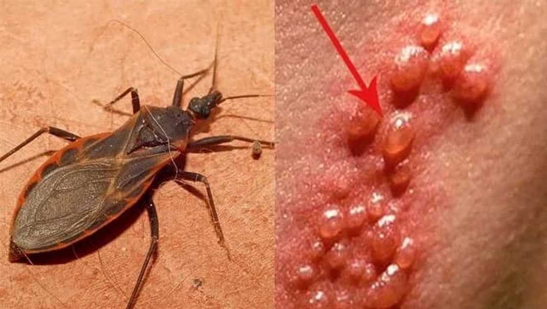 Kissing bugs infecting Filipinos with deadly Chagas disease