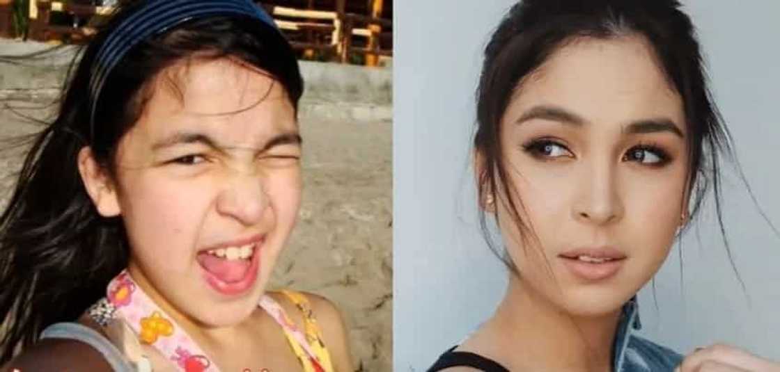 Noon at ngayon: These 16 Filipina celebrities experienced drastic transformation after hitting puberty Noon at ngayon: These 16 Filipina celebrities experienced drastic transformation after hitting puberty