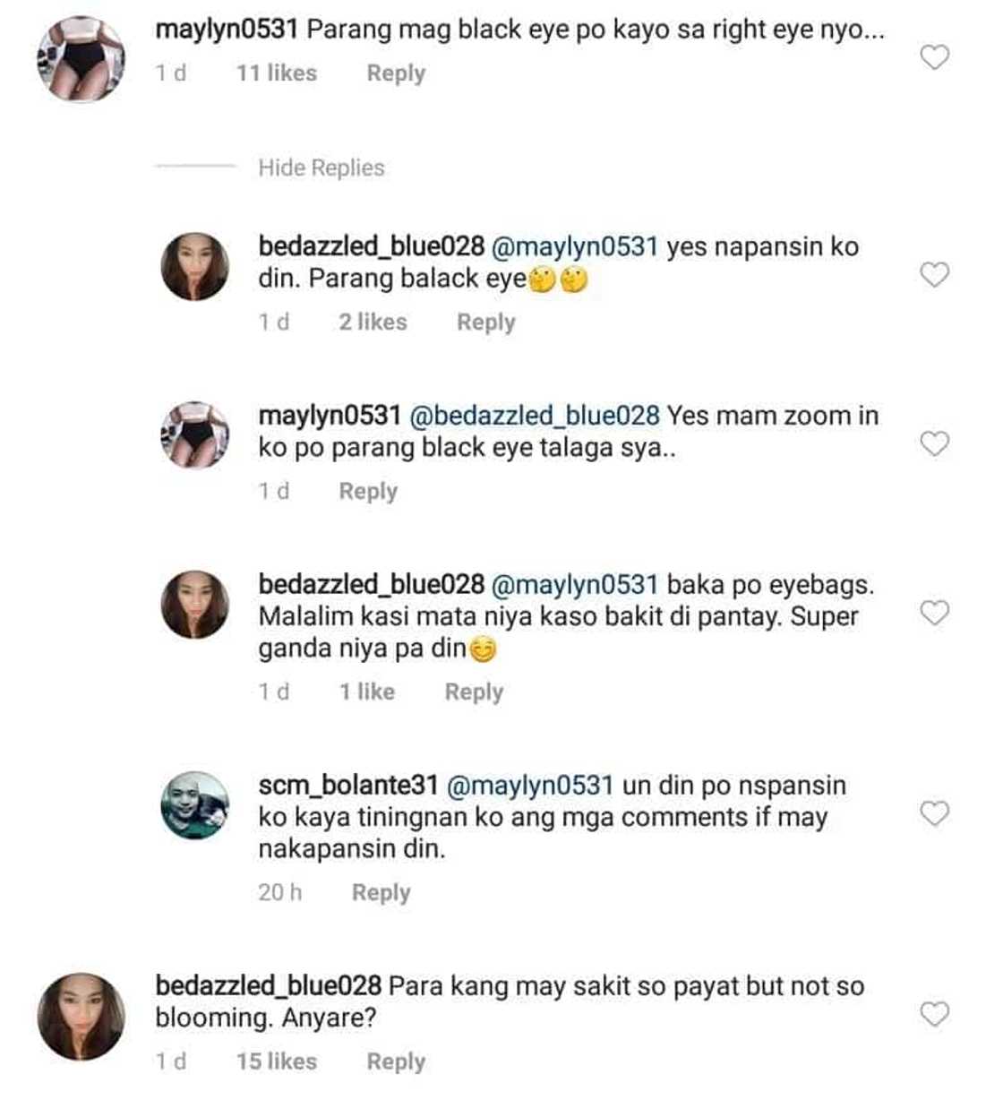 Ugly black marks around Maxene Magalona's eye leave netizens speculating on her situation