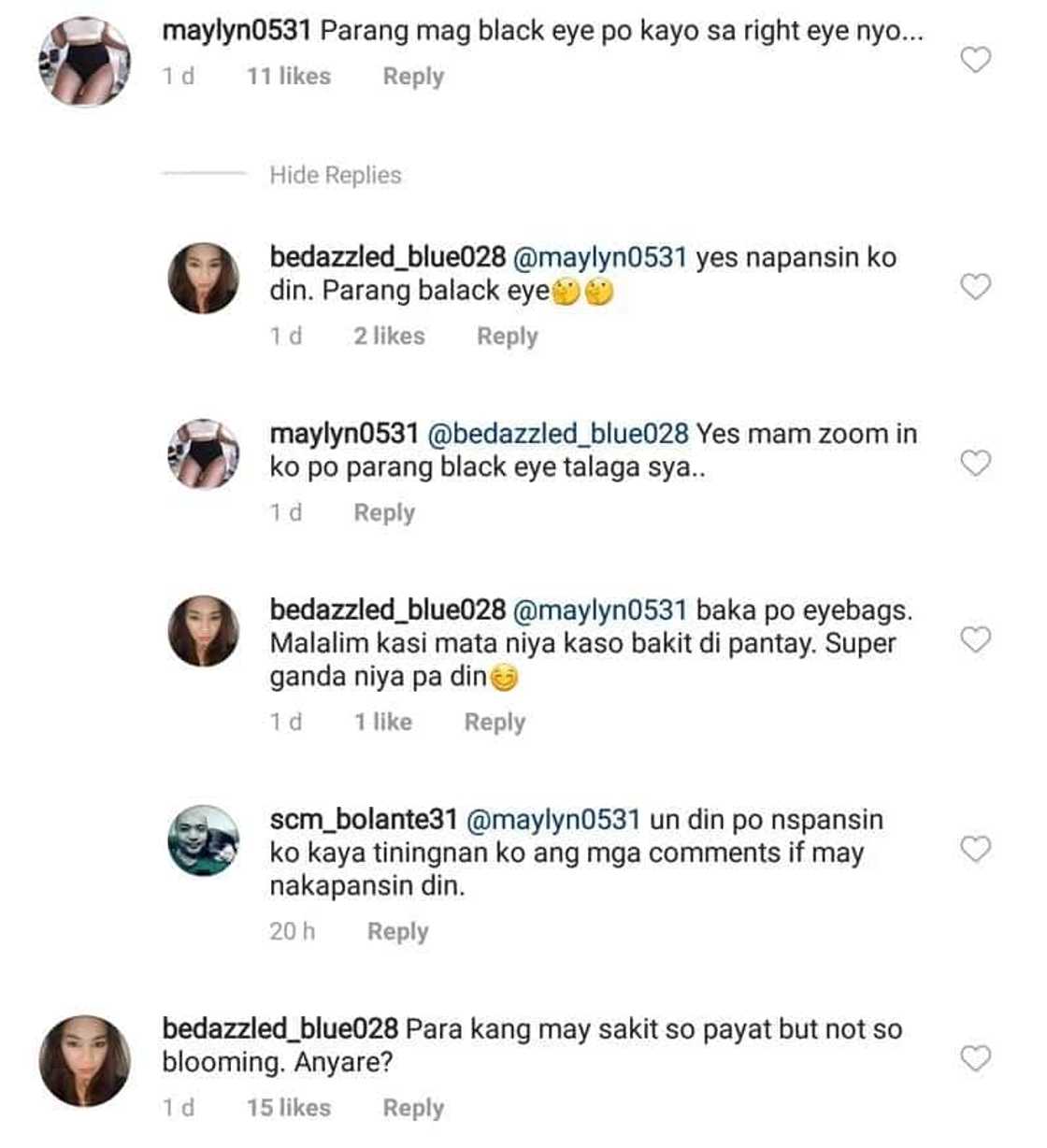 Ugly black marks around Maxene Magalona's eye leave netizens speculating on her situation Ugly black marks around Maxene Magalona's eye leave netizens speculating on her situation