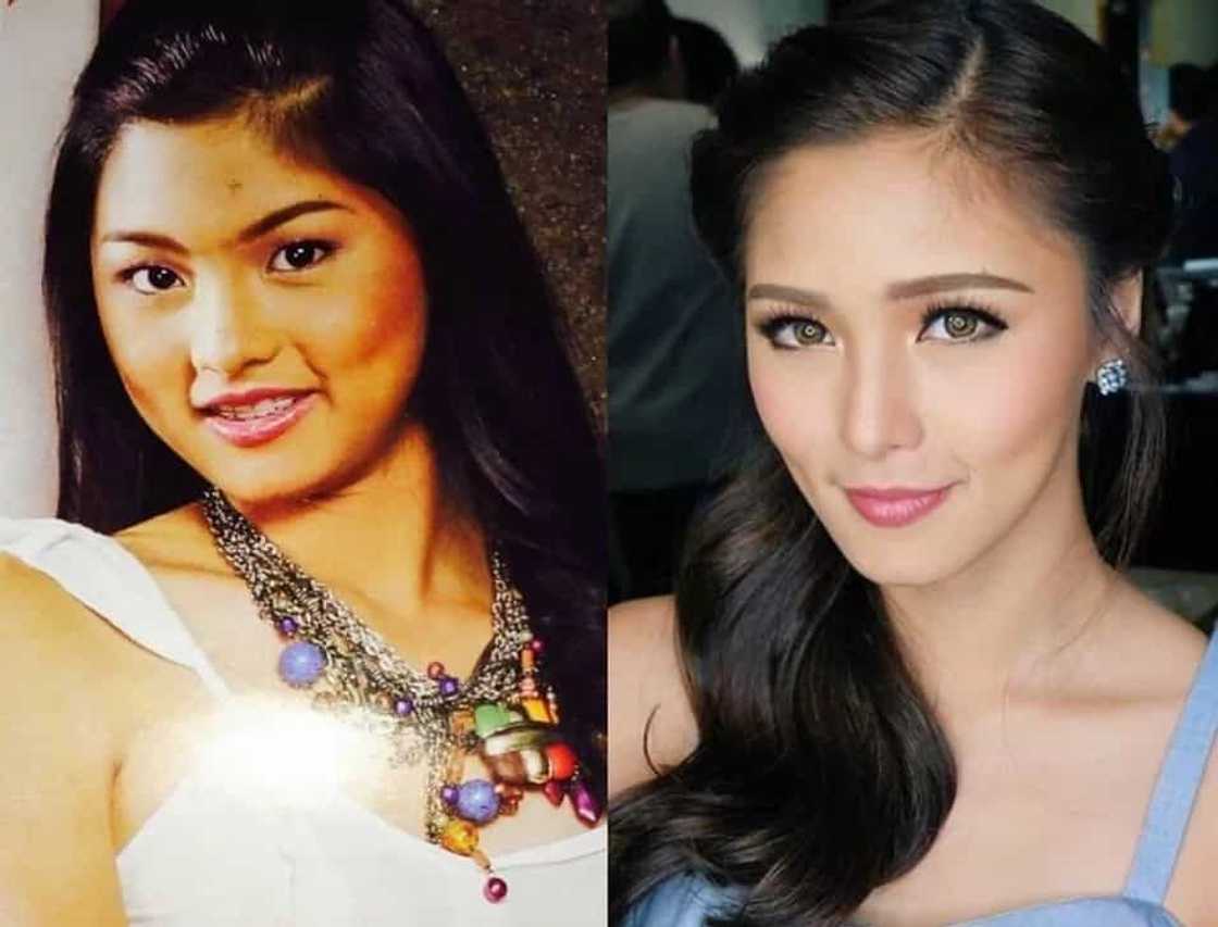 This is how these Filipina celebrities looked like before