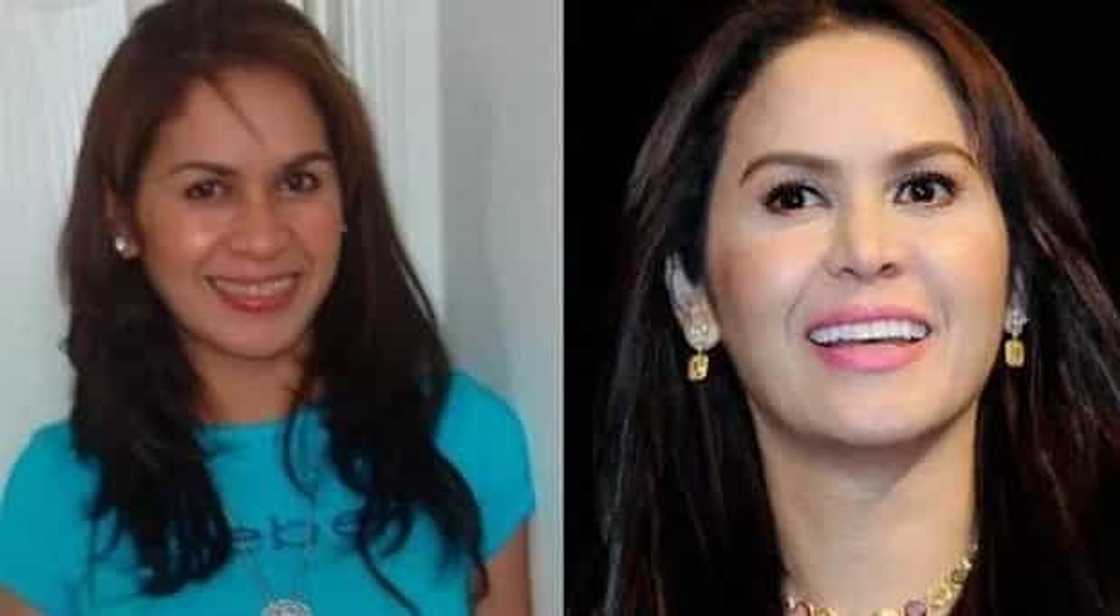 Jinkee Pacquiao's before and after photos are shocking Jinkee Pacquiao's before and after photos are shocking