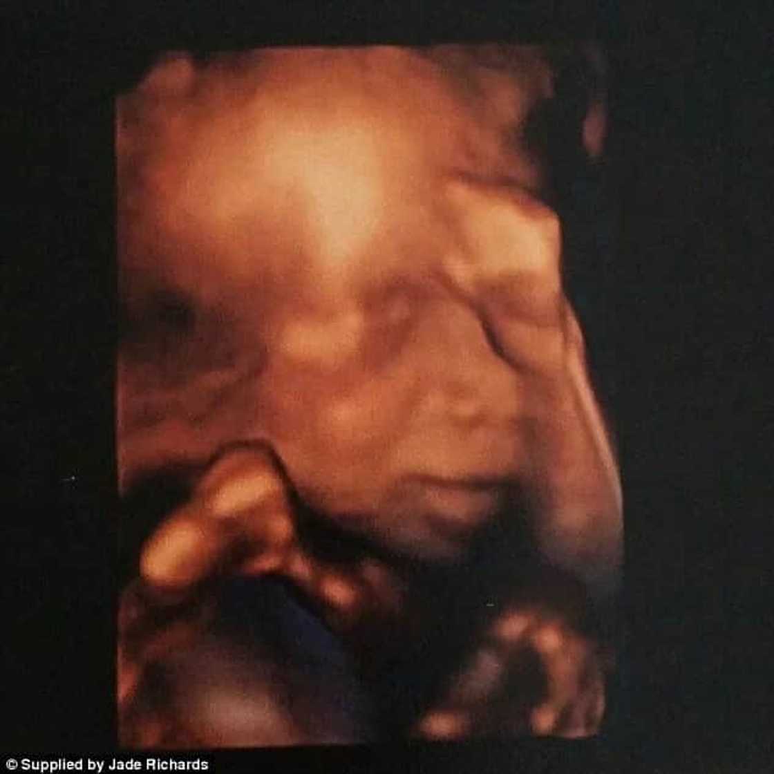 The way this lesbian couple conceived their child is incredible! The way this lesbian couple conceived their child is incredible!