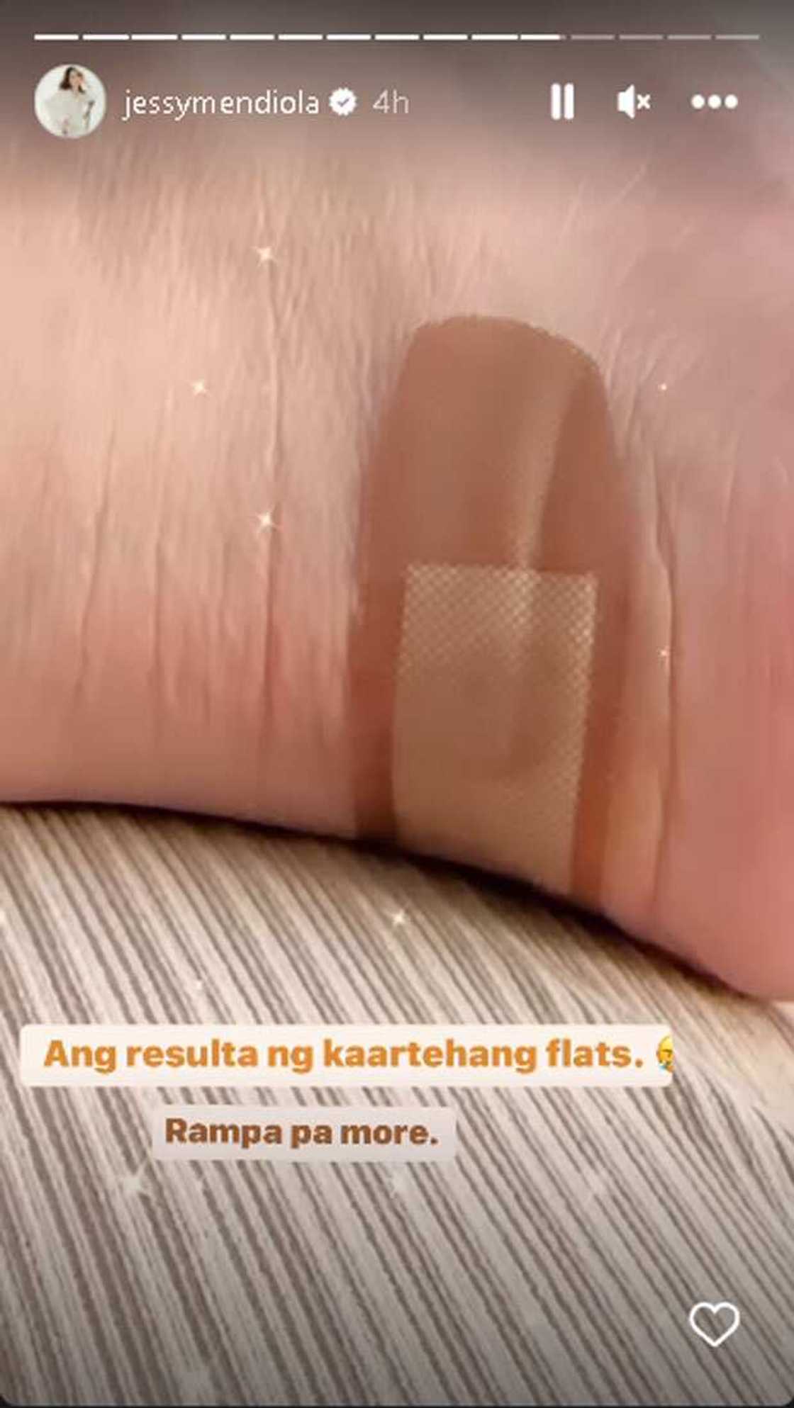 Jessy Mendiola Jessy Mendiola