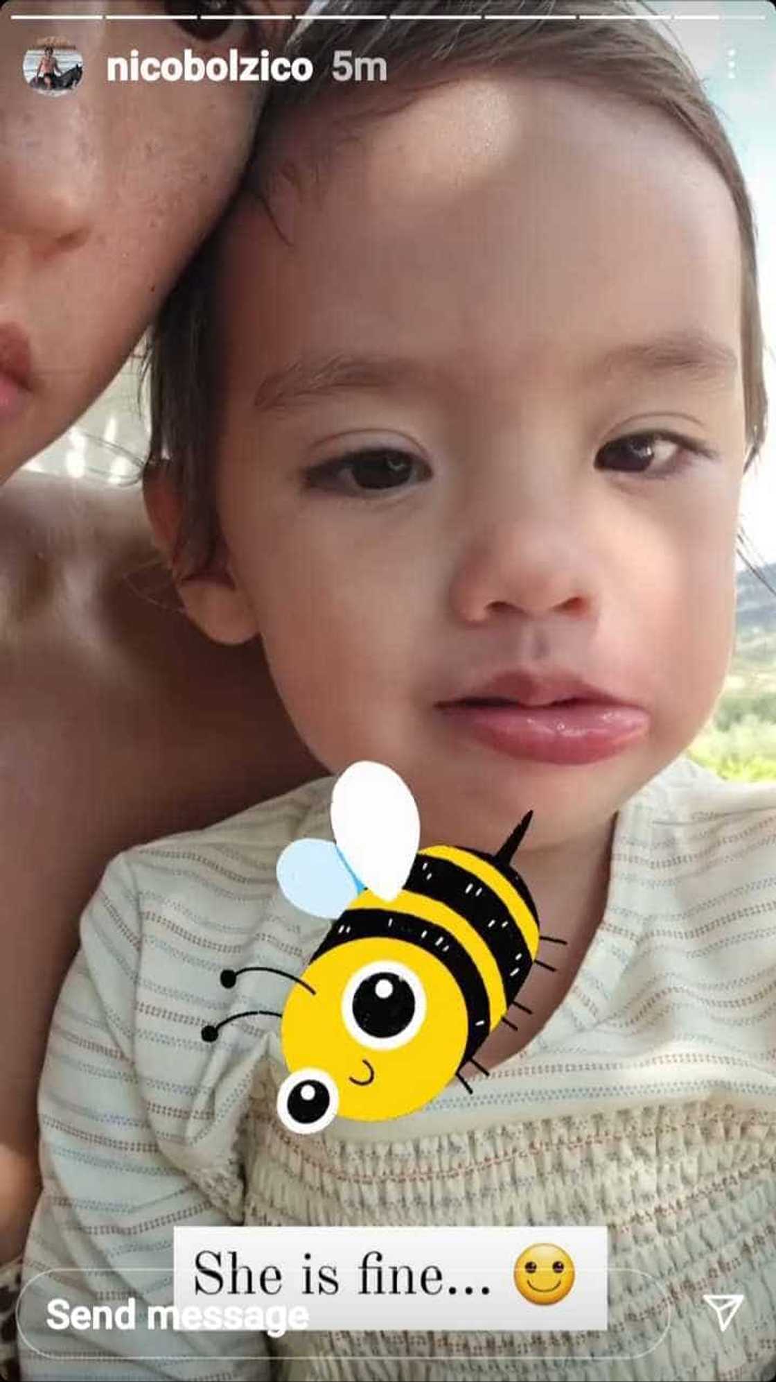 Baby Thylane’s lip gets stung by a bee; netizens worried for the baby girl Baby Thylane’s lip gets stung by a bee; netizens worried for the baby girl