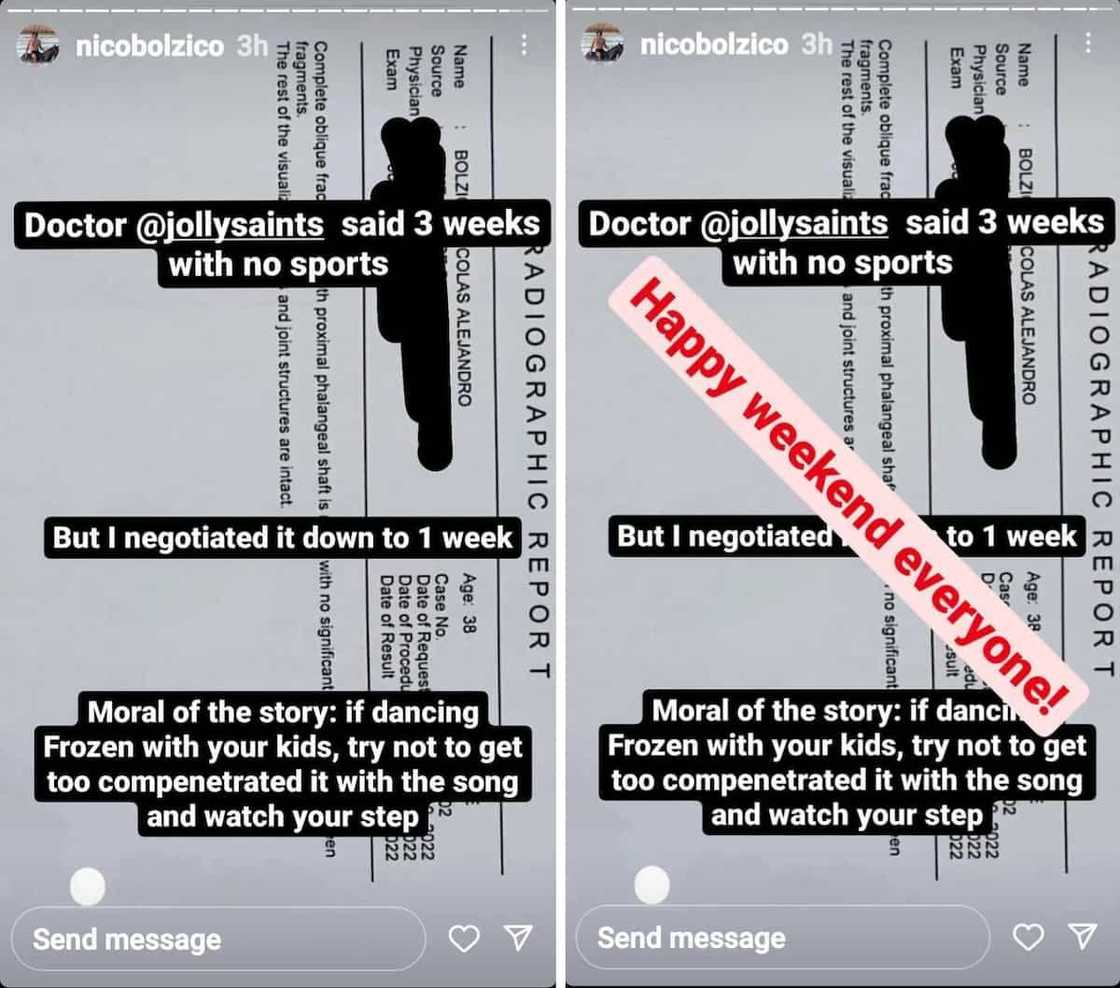 Nico Bolzico, na-fracture ang pinky toe habang sumasayaw kasama si baby Thylane Nico Bolzico, na-fracture ang pinky toe habang sumasayaw kasama si baby Thylane