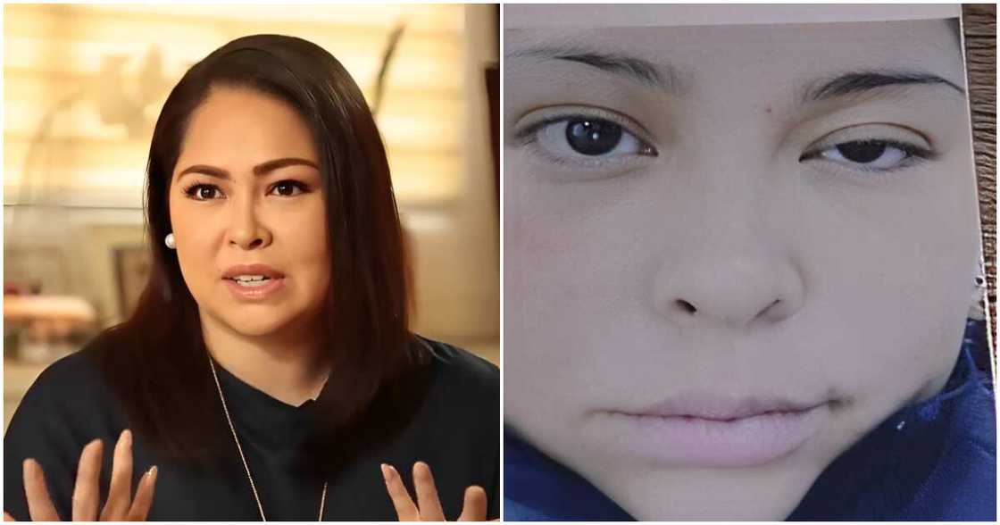 Angelu de Leon, binahagi ang kanyang pakikipaglaban sa sakit na Bell's Palsy