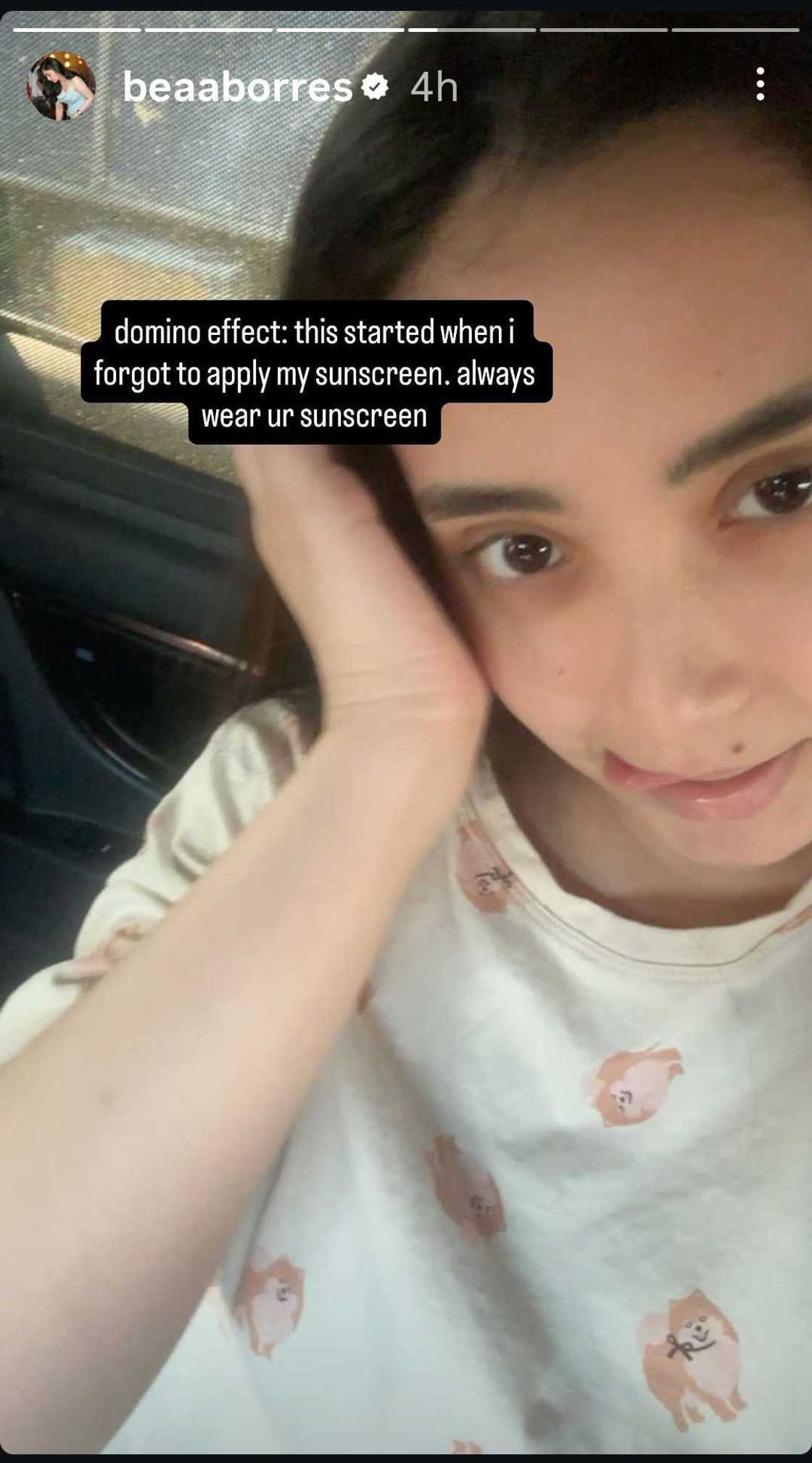 Bea Borres laments car accident: “It hasn't even been a year nabangga na alphard ko” Bea Borres laments car accident: “It hasn't even been a year nabangga na alphard ko”