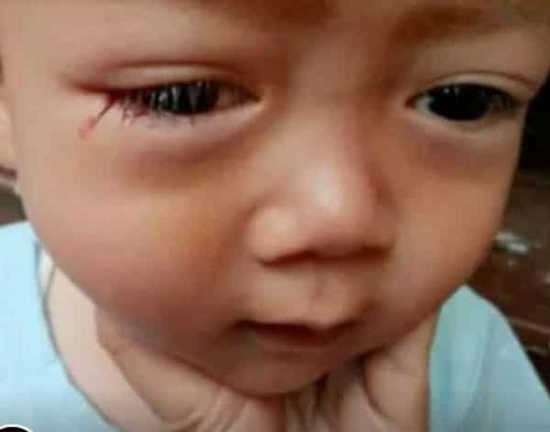 Pagluha ng dugo ng anak, sinisi ng ina sa sobrang paggamit ng gadget Pagluha ng dugo ng anak, sinisi ng ina sa sobrang paggamit ng gadget