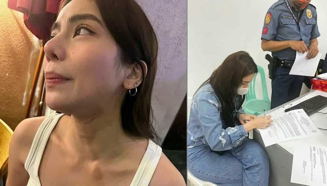 Umano'y photos ni Debbie Garcia matapos ang physical altercation nila ni Barbie Imperial, viral Umano'y photos ni Debbie Garcia matapos ang physical altercation nila ni Barbie Imperial, viral