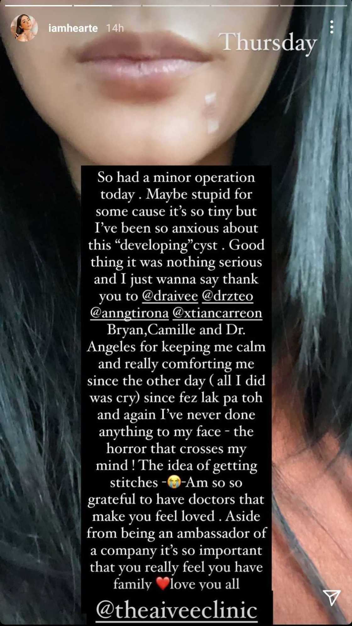 Heart Evangelista, inoperahan dahil sa "developing" cyst sa kanyang mukha Heart Evangelista, inoperahan dahil sa "developing" cyst sa kanyang mukha