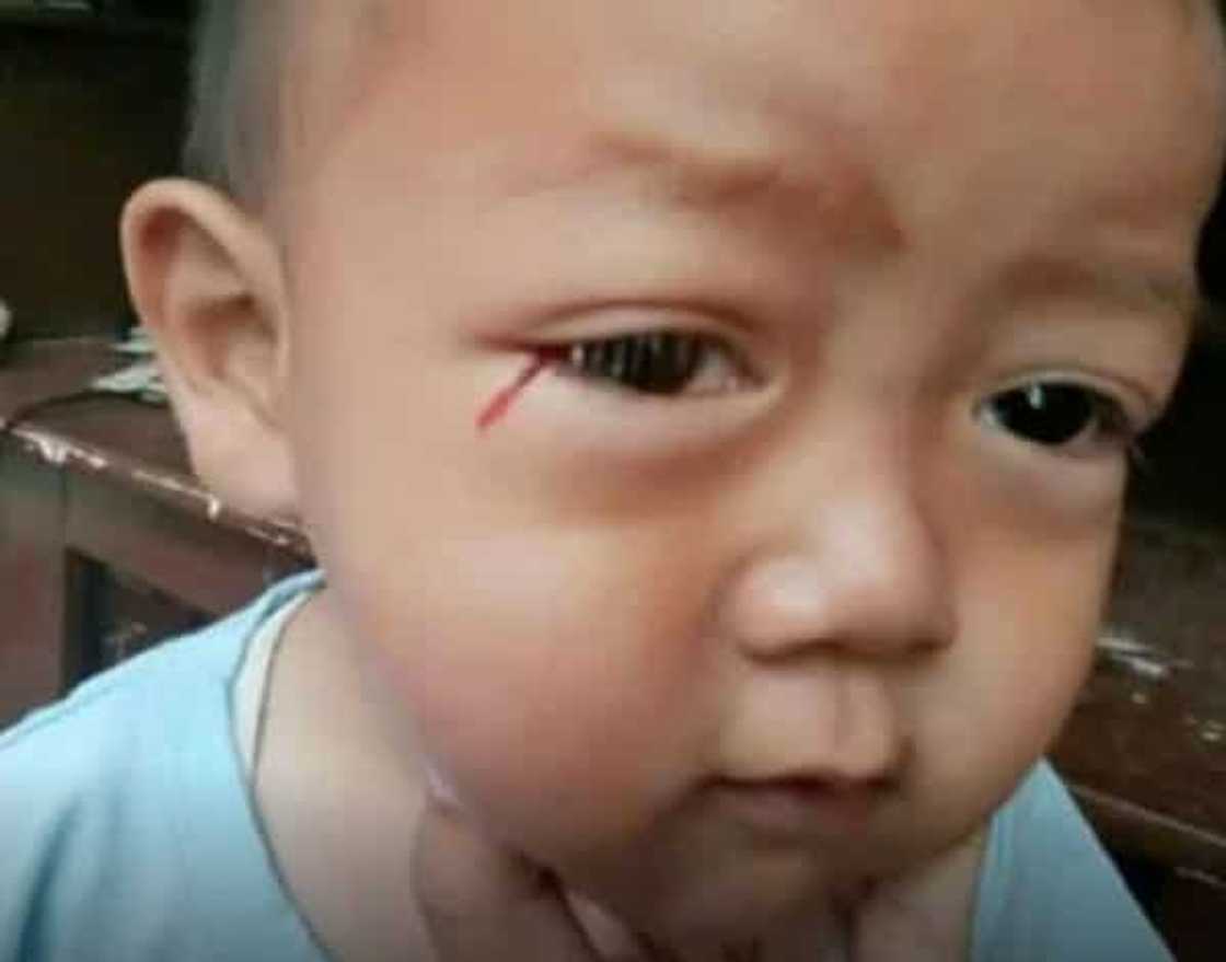 Pagluha ng dugo ng anak, sinisi ng ina sa sobrang paggamit ng gadget