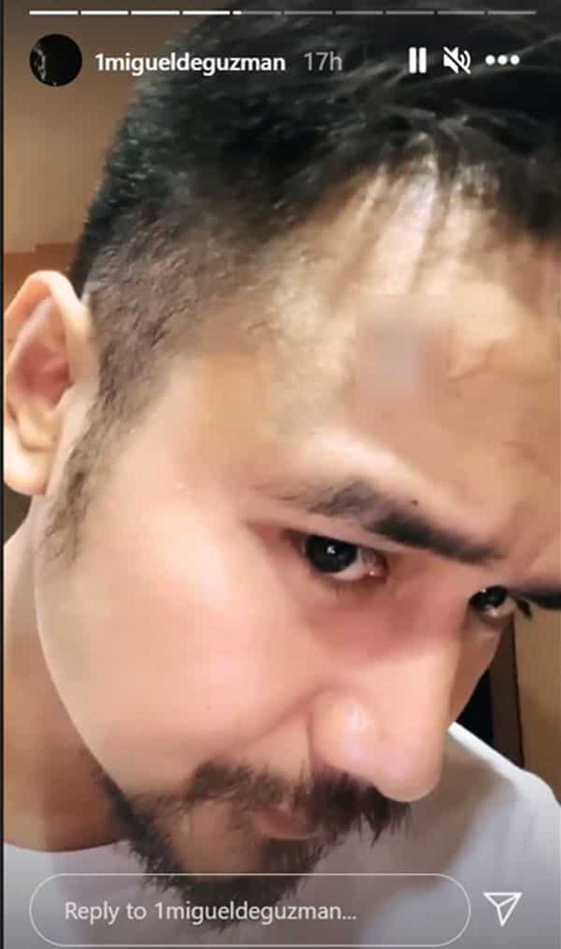 JM De Guzman suffers head injury during taping, "Init Sa Magdamag" JM De Guzman suffers head injury during taping, "Init Sa Magdamag"