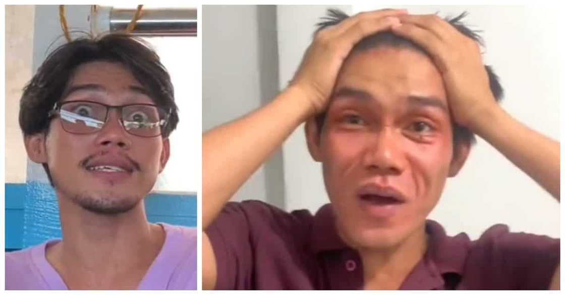 Content creator, umano'y na-trauma sa nangulubot na mukha matapos gumamit ng facial mask