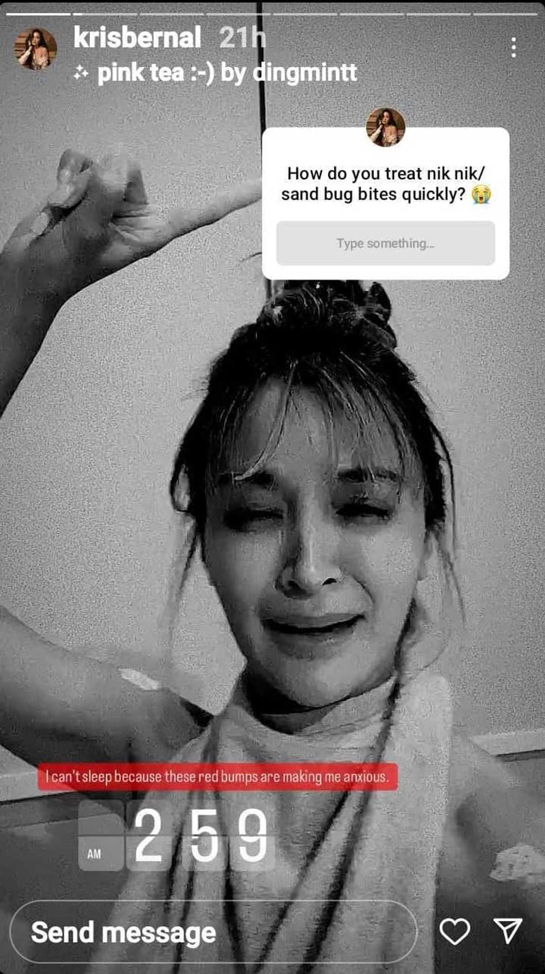 Kris Bernal, labis na na-stress nang napuno ng niknik bites ang katawan Kris Bernal, labis na na-stress nang napuno ng niknik bites ang katawan