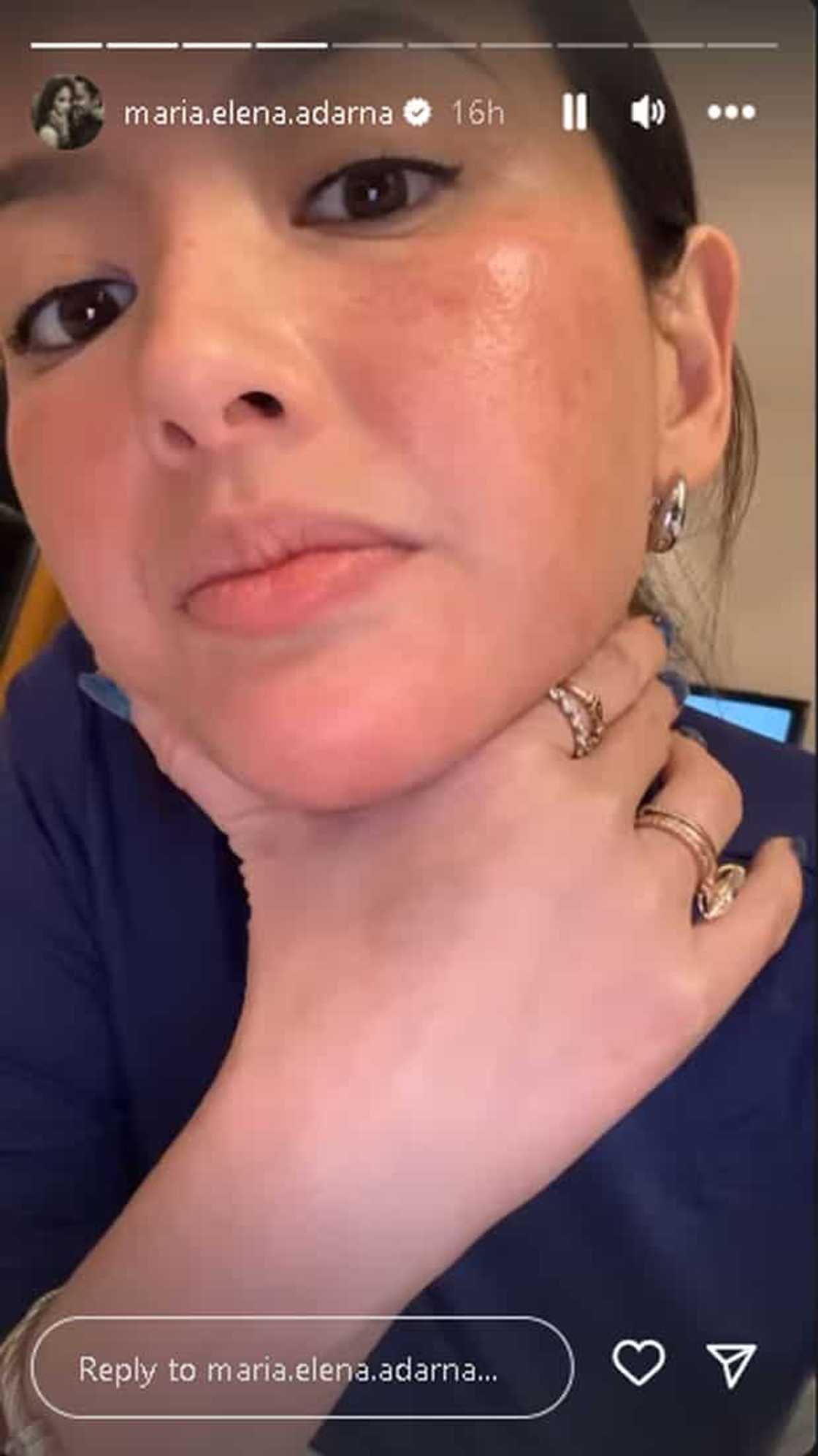 Ellen Adarna Ellen Adarna