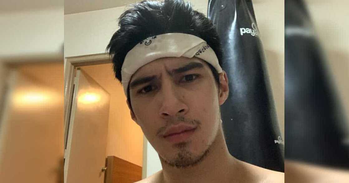 Albie Casiño, may galit pa sa taong nanakit sa kanya: "I don't think na mawawala na 'yon e" Albie Casiño, may galit pa sa taong nanakit sa kanya: "I don't think na mawawala na 'yon e"