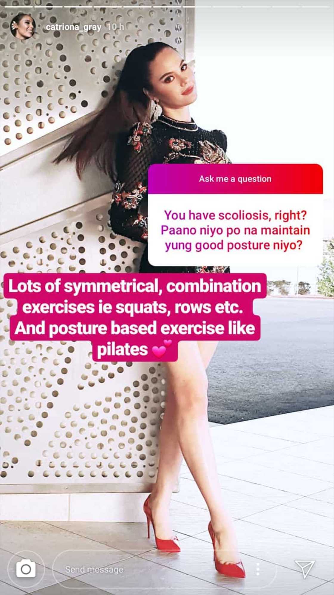 Catriona Gray explains how she manages to maintain good posture despite having scoliosis Catriona Gray explains how she manages to maintain good posture despite having scoliosis