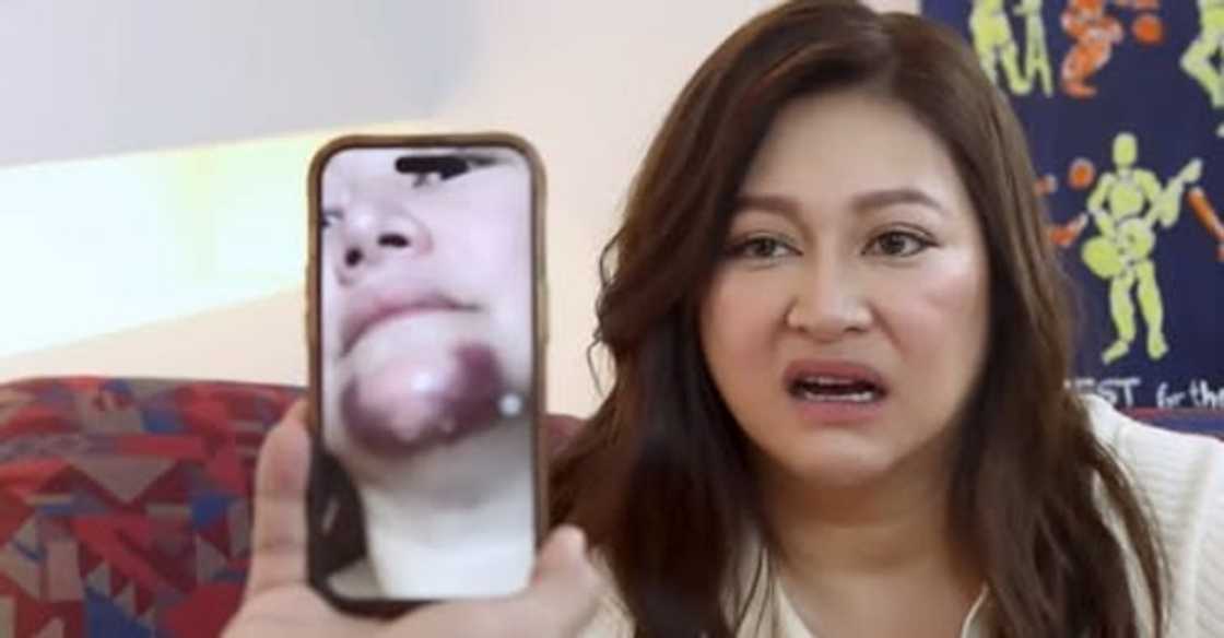 Rufa Mae Quinto, ibinahagi ang near-death experience sa Amerika