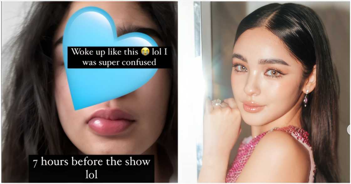 Andrea Brillantes, na-stress sa kanyang namagang bibig ilang oras bago ang ABS-CBN Christmas Special